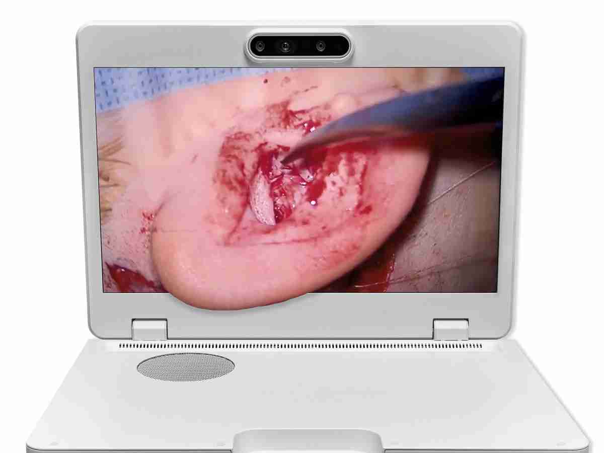 达擎之＂Heads-up 3D显微手术显示系统＂，，，，整合4K裸眼3D显示及眼球追踪系统，，具备快速追踪人眼移动位置功能，，，，减轻医师长时间维持固定姿势的负担，，，让医师能有更宽广清晰的3D立体视野及更舒适的姿势来执行手术。。。。